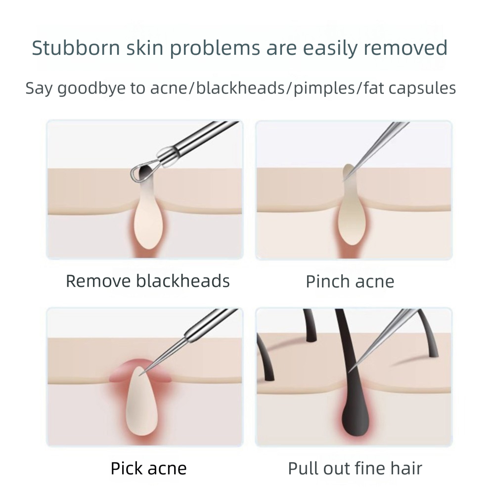3-5 szt. Pęseta do wrastającyc – Hair Care Clinic recenzja i cena