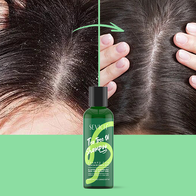 Zestaw Szamponu i Odżywki z Es – Hair Care Set recenzja i cena